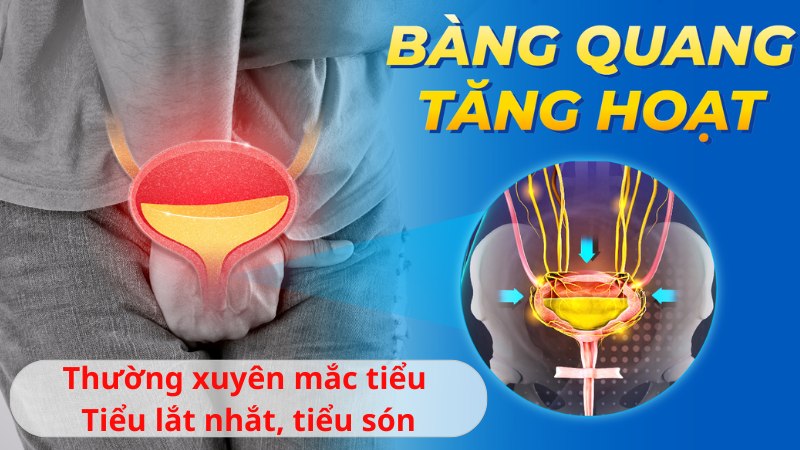 13 cách chữa bàng quang tăng hoạt tại nhà hiệu quả rõ rệt